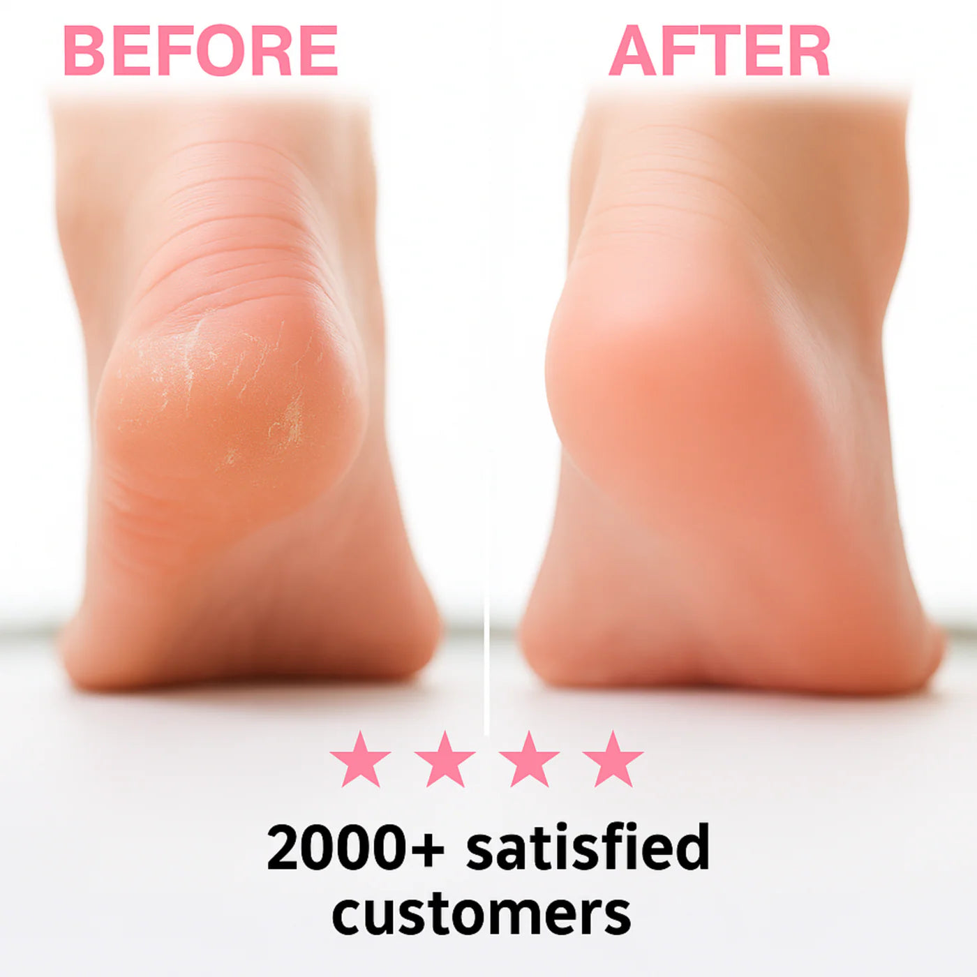 CALLUSCLEAR Foot Clean